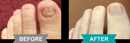 Emoninail Customer Reviews