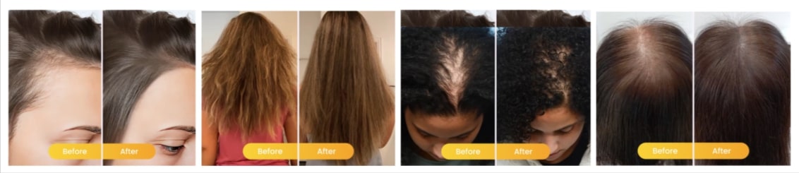 WellaNaturals Hair Oil - Benefits