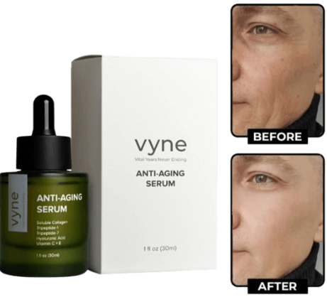 VYNE Anti Aging Serum Before-And-After