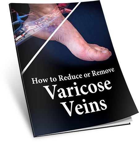 Varicose 911 Bonus 2