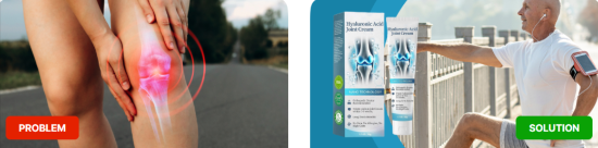 Veluflex UK Solution